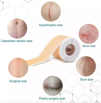 PARCHE CINTA CICATRIZANTE DE SILICONA